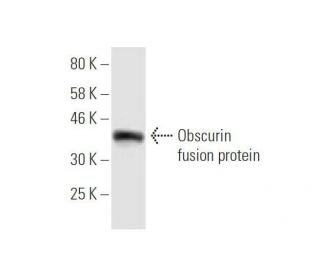 Obscurin Antibody (5C20) - Western Blotting - Image 350283