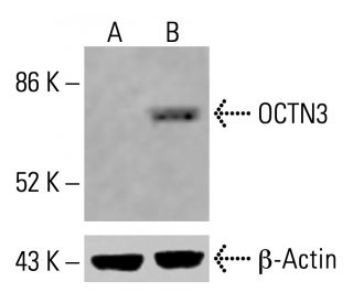 OCTN3 Antibody (B-10) - Western Blotting - Image 414625 