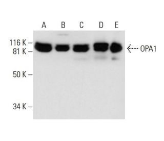 OPA1 Antibody (D-9) - Western Blotting - Image 294530SAM Transcription Activation: SAM system utilizing dCas9-VP64, MS2-P65-HSF1, and sgRNA for precise gene transcription activation.