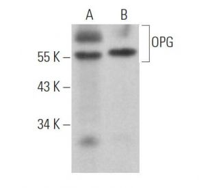 OPG/Osteoprotegerin Antibody (E-10) - Western Blotting - Image 361687Each CRISPR/Cas9 Knockout (KO) Plasmid product consists of a pool of 3 plasmids designed to ensure identification and cleavage of a specific gene for maximum knockout efficiency. Each plasmid encodes a unique 20 nt sequence derived from the GeCKO (v2) library.
