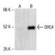 ORC4 Antibody (H-2) - Western Blotting - Image 412253