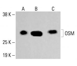 OSM Antibody (B-6) - Western Blotting - Image 413447 