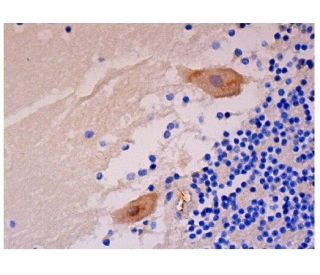 OSMR &beta; Antibody (AN-A2) - Immunohistochemistry - Image 290447