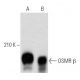 OSMR β Antibody (C-7) - Western Blotting - Image 357001 