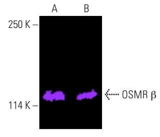 OSMR &beta; Antibody (D-10) - Western Blotting - Image 401805 