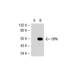 osteopontin/OPN/SPP1 Antibody (AKm2A1) - Western Blotting - Image 39887