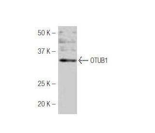 OTUB1 Antibody (J-61) - Western Blotting - Image 53958The Double Nickase Plasmid features a U6 promoter for sgRNA expression, a 20 nt targeting sequence, and a gRNA scaffold to guide Cas9n. It includes a CBh promoter for Cas9n (D10A) and puromycin resistance, GFP for transfection verification, and nuclear localization signals (NLS). The 2A peptide allows co-expression of Cas9n and Puro from a single promoter, enabling precise genome editing with reduced off-target effects.