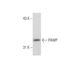 OV-90 Whole Cell Lysate: sc-364191. Western blot analysis of PAWP... 