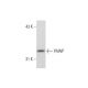 OV-90 Whole Cell Lysate: sc-364191. Western blot analysis of PAWP... 