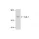 OV-90 Whole Cell Lysate: sc-364191. Western blot analysis of Sulf-2...