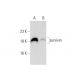 survivin (D-8): sc-17779. Western blot analysis of survivin expression in untreated (A) and Oxaliplatin (sc-202270) treate 