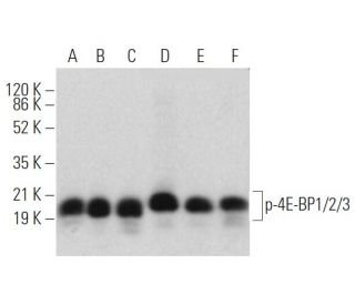 p-4E-BP1/2/3 Antibody (A-10) - Western Blotting - Image 374935 