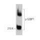 p-53BP1 Antibody (38.Ser 25) - Western Blotting - Image 373038