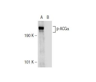 p-ACC&alpha; Antibody (F-2) - Western Blotting - Image 146930 