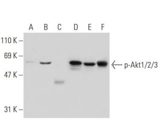 p-Akt1/2/3 Antibody (11E6) - Western Blotting - Image 136023 