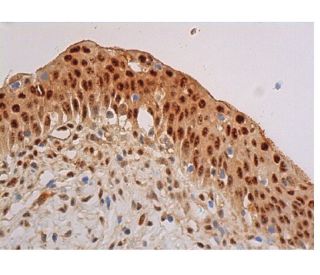 p-Akt1/2/3 Antibody (B-12) - Immunohistochemistry - Image 347992 