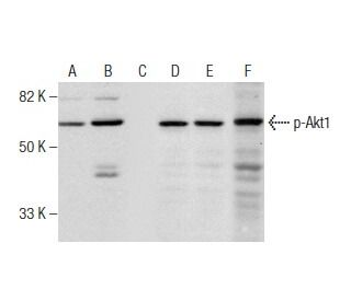 p-Akt1 Antibody (5.Ser 473) - Western Blotting - Image 159341 