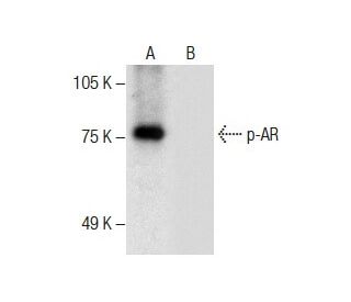Androgen Receptor Antibody (E-6) - Western Blotting - Image 287666