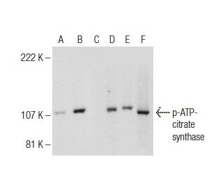 p-ATP-citrate synthase Antibody (A-12) - Western Blotting - Image 155209