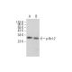 p-Bcl-2 Antibody (367.Ser 70) - Western Blotting - Image 377059
