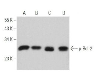 p-Bcl-2 Antibody (367.Ser 70) - Western Blotting - Image 377314 