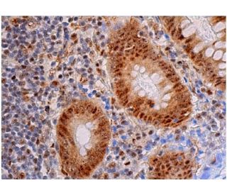 p-Bcl-2 Antibody (A-11) - Immunohistochemistry - Image 348055 