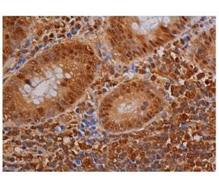 p-Bcl-2 Antibody (C-2) - Immunohistochemistry - Image 348058 