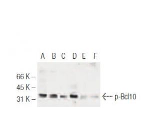 p-Bcl10 Antibody (6D3) - Western Blotting - Image 62918 