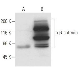 p-beta-catenin Antibody (1B11) - Western Blotting - Image 62880
