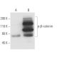 p-beta-catenin Antibody (1B11) - Western Blotting - Image 62880