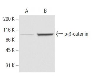 p-beta-catenin Antibody (24E1) - Western Blotting - Image 62881