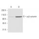 p-beta-catenin Antibody (24E1) - Western Blotting - Image 62881