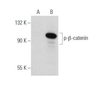 p-beta-catenin Antibody (BC-22) - Western Blotting - Image 34784 