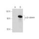 p-beta-catenin Antibody (BC-22) - Western Blotting - Image 34784 