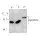 p-beta-catenin Antibody (BC-22) - Western Blotting - Image 370448