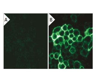 p-&beta;-dystroglycan Antibody (pY892.27.1) - Immunofluorescence - Image 133194 