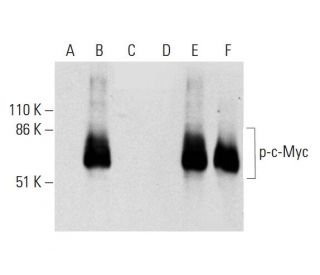 p-Myc Antibody (C-3) - Western Blotting - Image 289907 