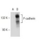 P-cadherin Antibody (12H6) - Western Blotting - Image 126237 