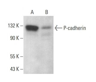 P-cadherin Antibody (12H6) - Western Blotting - Image 378448 