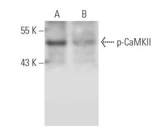p-CaMKII Antibody (22B1) - Western Blotting - Image 14776 