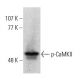 p-CaMKII Antibody (22B1) - Western Blotting - Image 364809