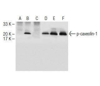 p-caveolin-1 Antibody (G-10) - Western Blotting - Image 150618 