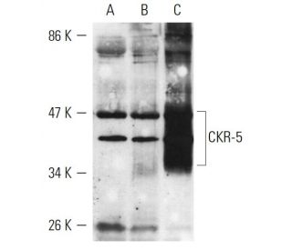 p-CKR-5 Antibody (E11/19) - Western Blotting - Image 9229
