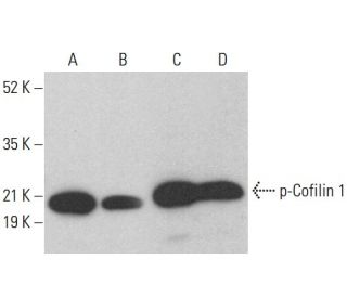 p-Cofilin 1 Antibody (E-5) - Western Blotting - Image 376469 