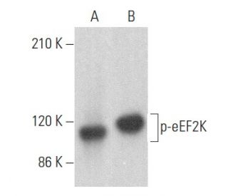 p-eEF2K Antibody (F-8) - Western Blotting - Image 355214 