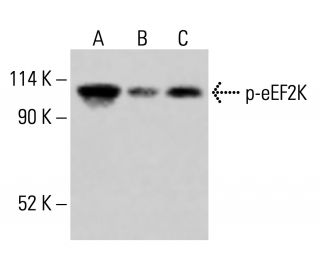 p-eEF2K Antibody (F-8) - Western Blotting - Image 414981