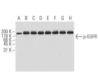 p-EGFR Antibody (11C2) - Western Blotting - Image 62882
