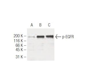 p-EGFR Antibody (3F2) - Western Blotting - Image 62886