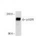 p-EGFR Antibody (6D373) - Western Blotting - Image 53283