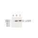 p-EGFR Antibody (8B8) - Western Blotting - Image 62923